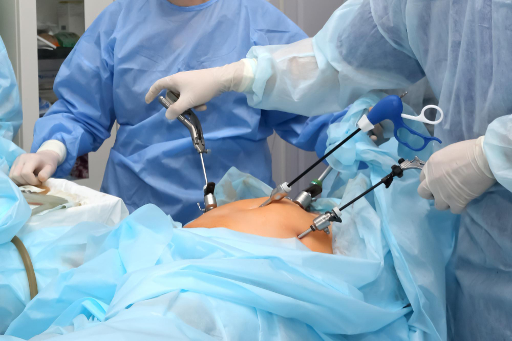 Laparoscopic Surgery Services