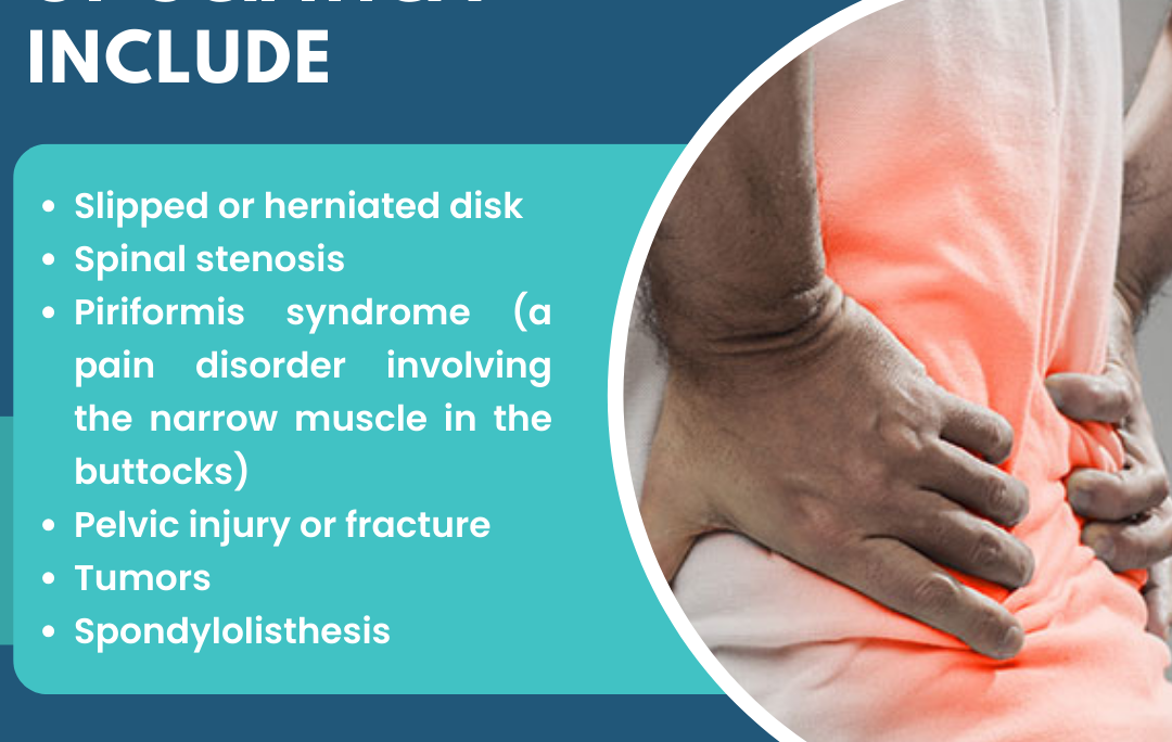 Common causes of sciatica include