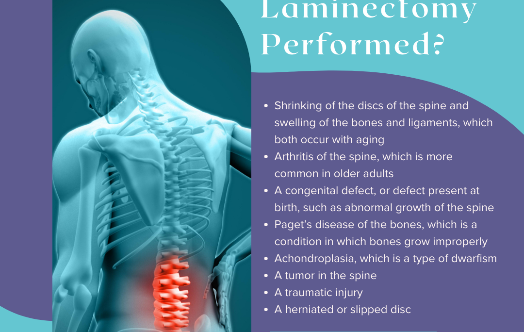 Why Is a Laminectomy Performed