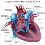 Infographic showing 6 common heart disease symptoms chest pain, shortness of breath, fatigue, and swelling.
