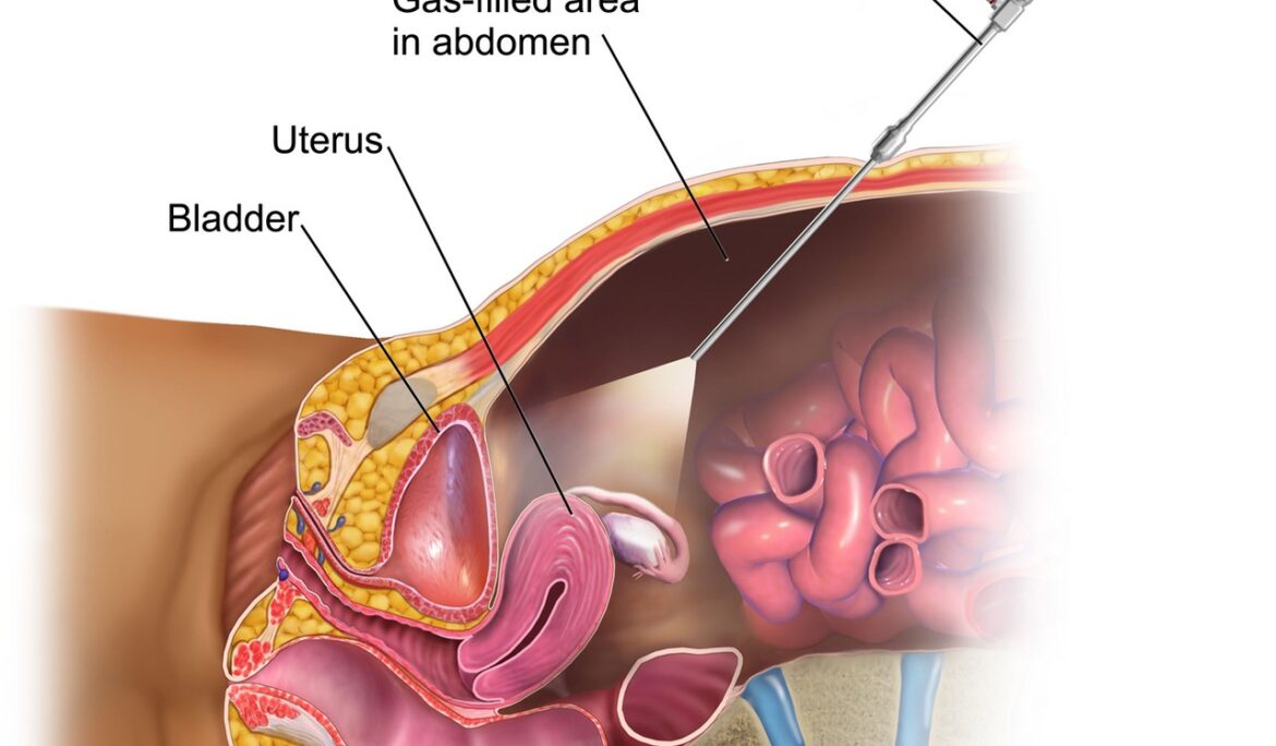 Laparoscopic Surgeon in Chinchwad - Dr. Dhananjay Patil Chetna Hospital