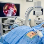 Endoscopic spine surgery L5 S1 minimally invasive procedure in operation theatre