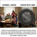 Eye clinic in Chinchwad providing AMD treatment services