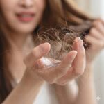 Ammonia-free-hair dye-benefits-the-skin-specialist-in-PCMC-