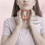 symptoms-of-thyroid-in-females.jpg