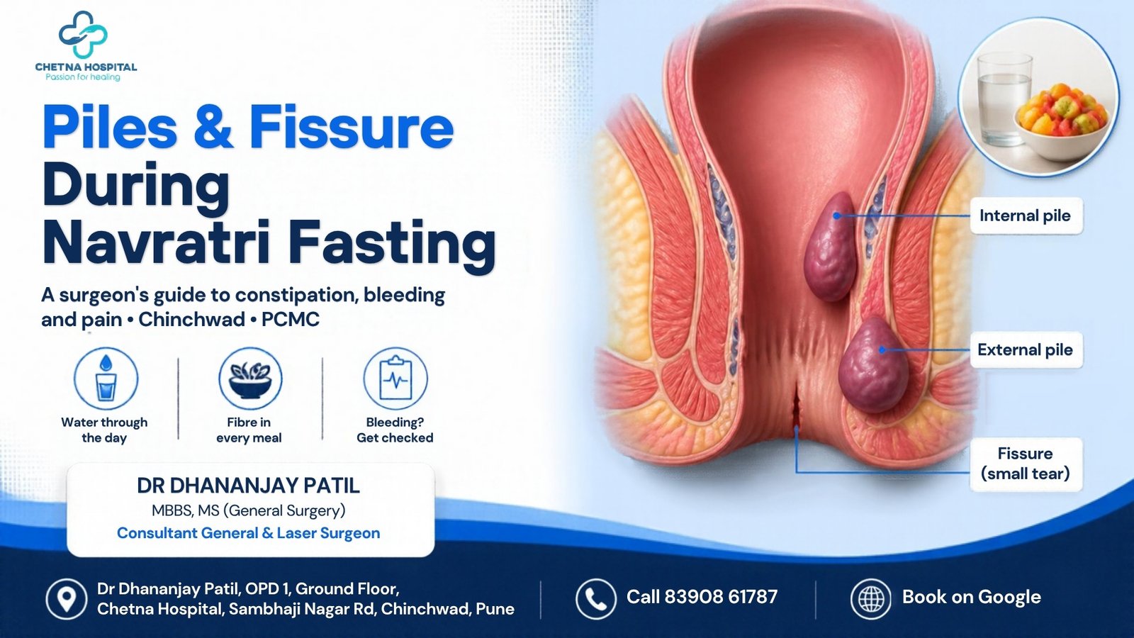 Infographic: piles and fissure during Navratri fasting, with a labelled diagram of an internal pile, external pile and fissure. Dr Dhananjay Patil, General Surgeon, Chetna Hospital, Chinchwad, Pune