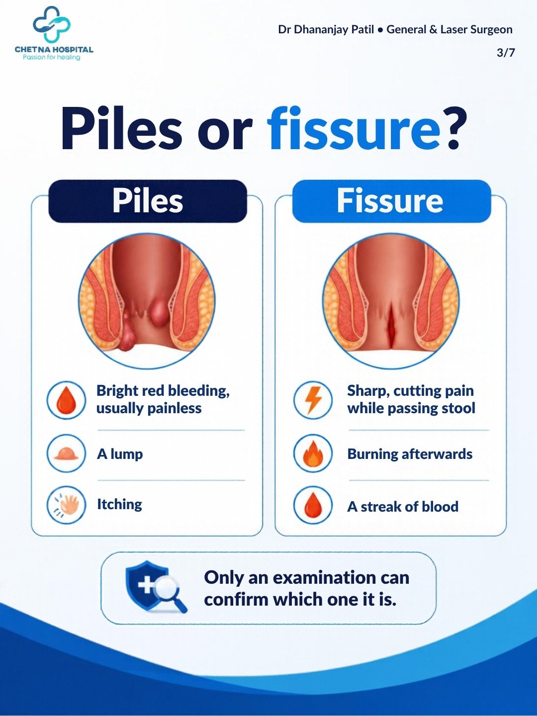 Slide 3: Piles or fissure? Labelled medical illustration comparing swollen veins (piles) with a small tear (fissure).
