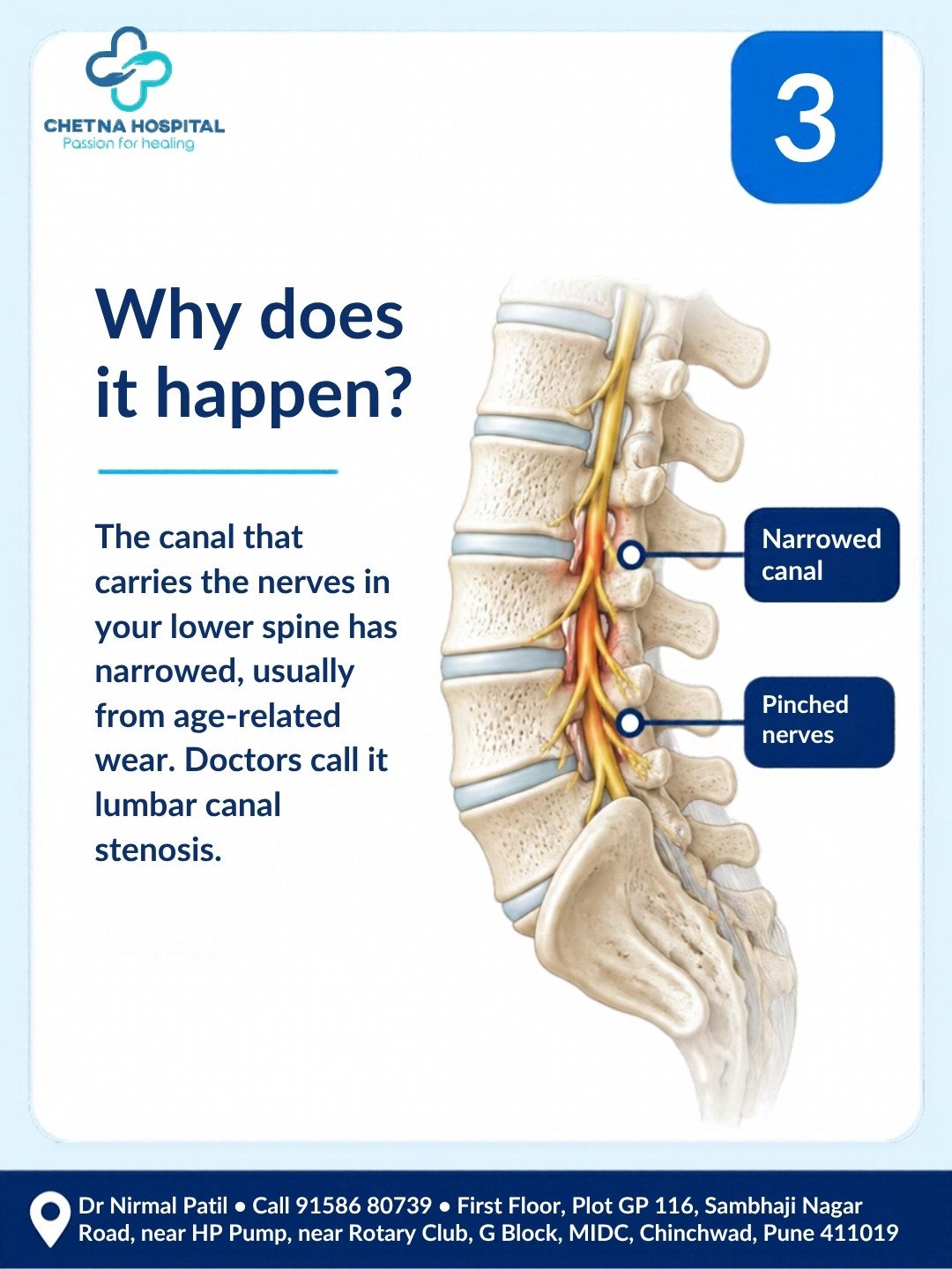 Slide 3: labelled spine diagram showing a narrowed nerve canal in the lower back and pinched nerves