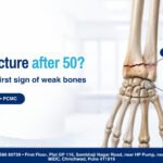 Wrist fracture after 50 from a small fall: check your bones. Dr Nirmal Patil, orthopaedic surgeon, Chinchwad, PCMC