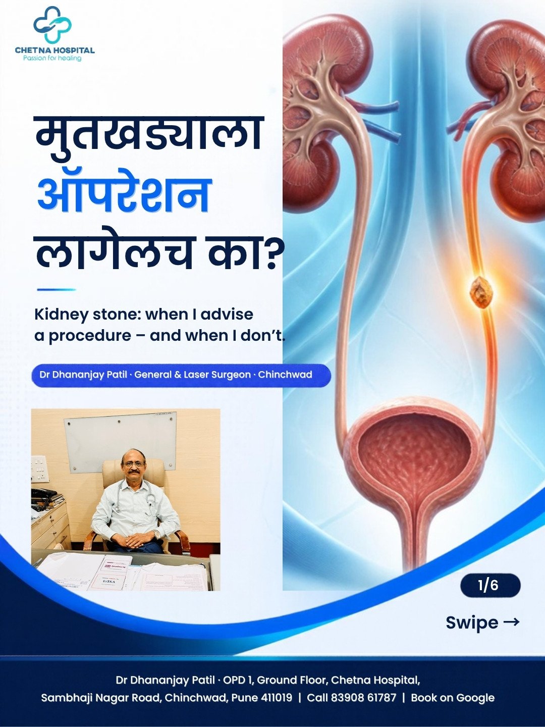 Slide 1: Does a kidney stone always need an operation? Marathi headline with kidney illustration and Dr Dhananjay Patil's photo
