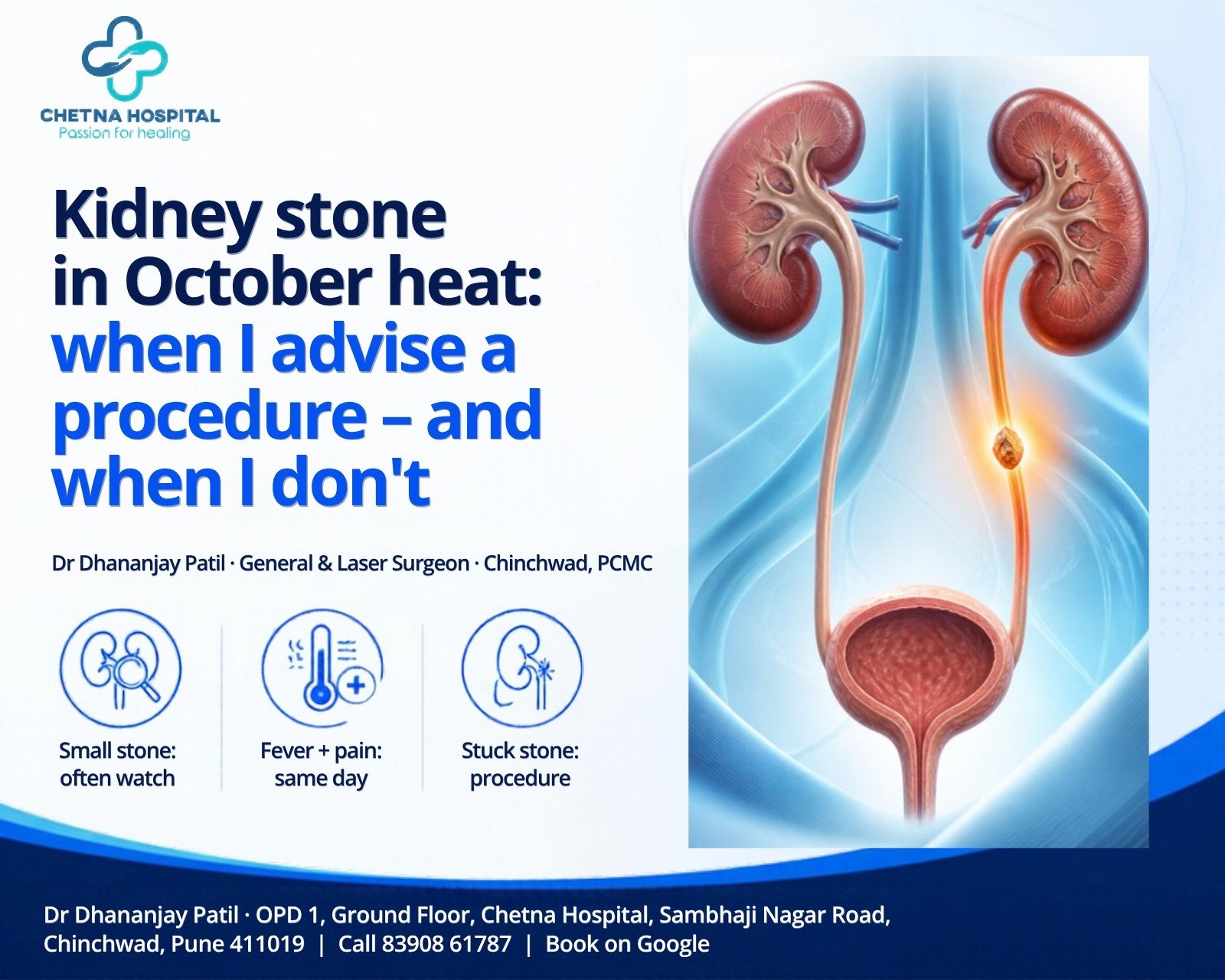 Kidney stone in October heat: when a surgeon advises a procedure and when he waits. Illustration of kidneys and ureter with a small stone. Dr Dhananjay Patil, General and Laser Surgeon, Chetna Hospital, Chinchwad, Pune