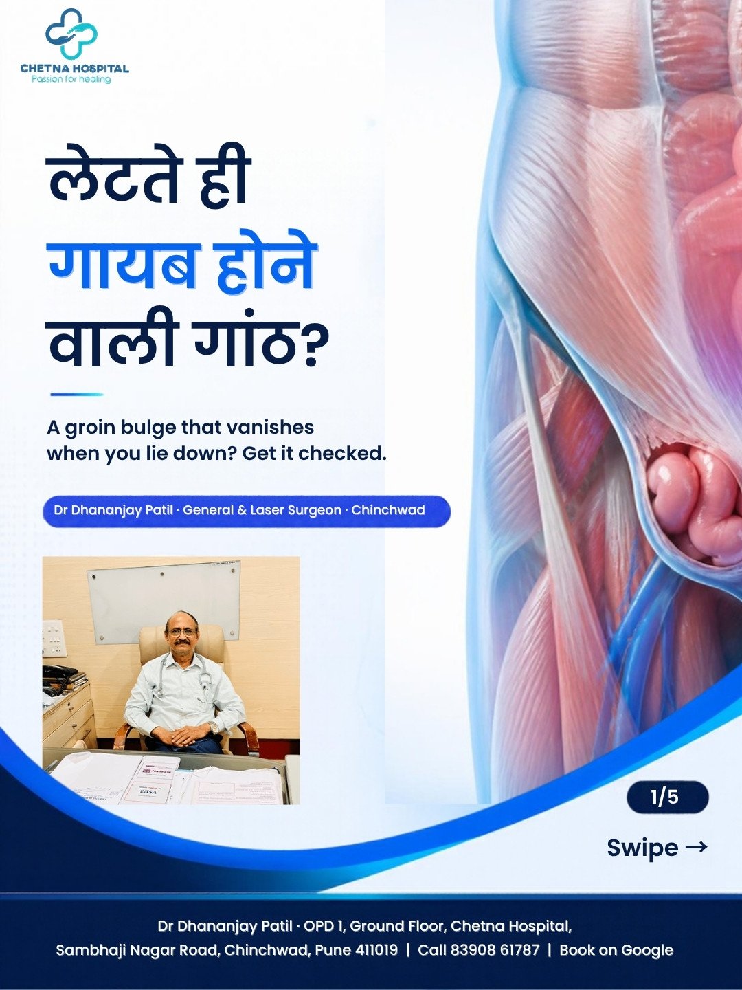 Slide 1: Hindi headline 'a lump that disappears when you lie down?' with a hernia illustration and a photo of Dr Dhananjay Patil, General and Laser Surgeon, Chinchwad