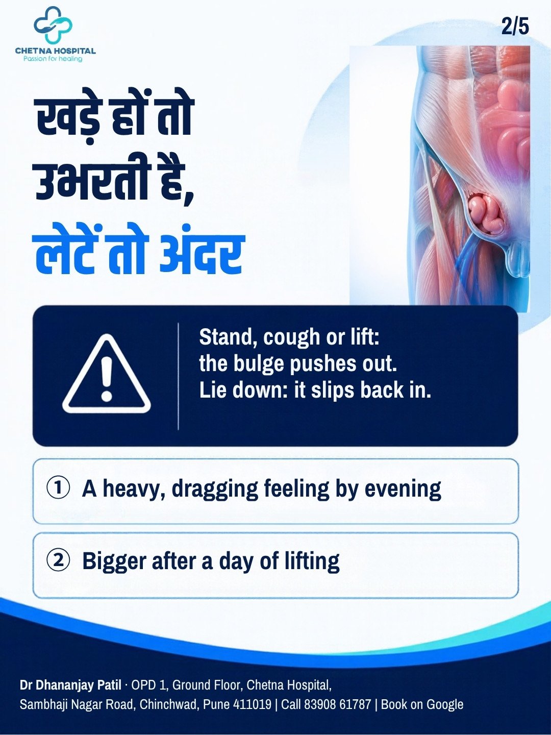 Slide 2: stand, cough or lift and the bulge pushes out; lie down and it slips back in; heavy feeling by evening; bigger after lifting