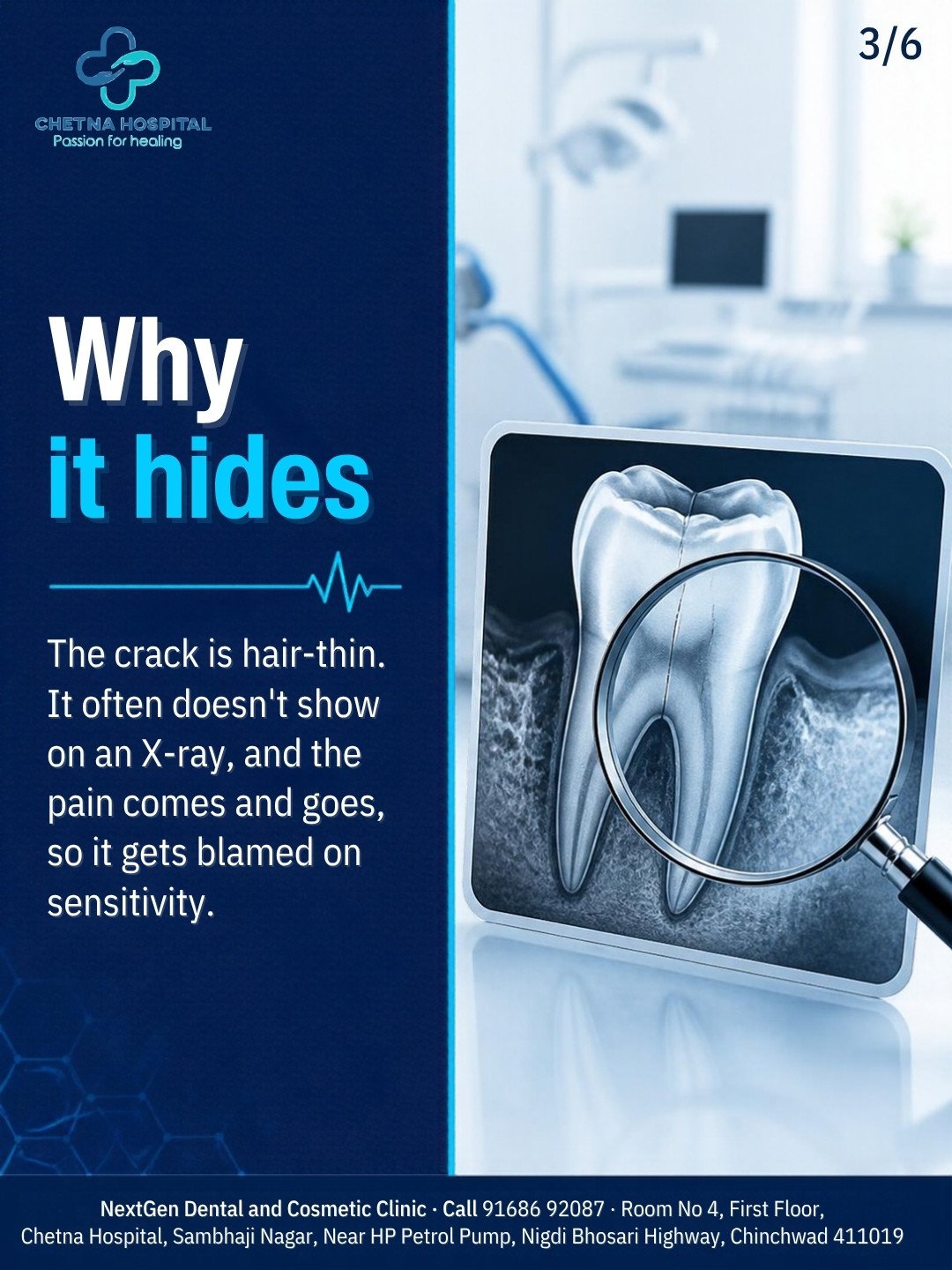 Carousel slide 3: Why it hides β a hair-thin crack often missed on a dental X-ray, X-ray film with magnifying glass