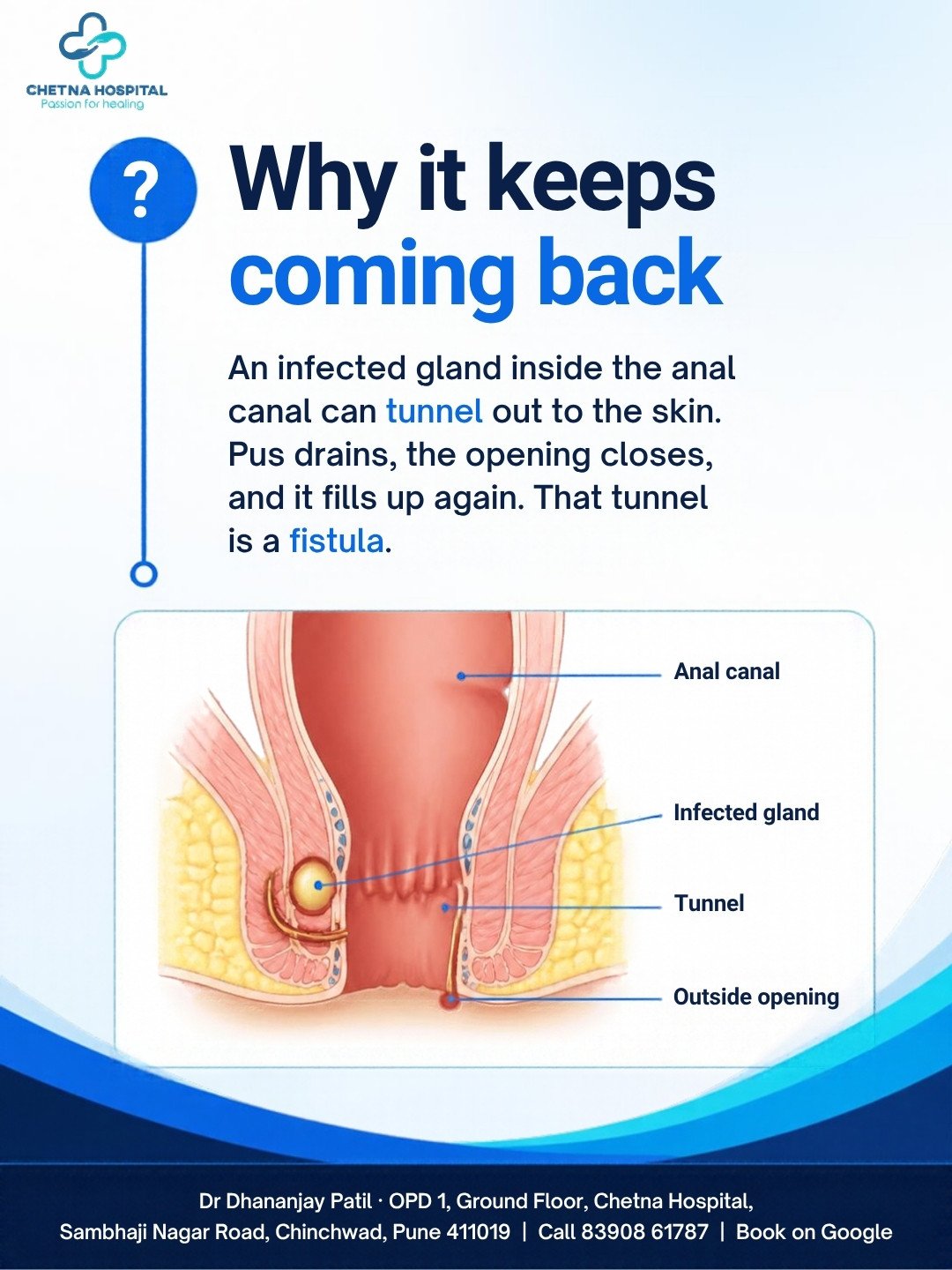 Slide 2: Why it keeps coming back. Labelled diagram of the anal canal, infected gland, tunnel and outside opening